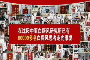 1539073867860080.jpg 辽宁白癜风去哪里治疗好_副本.jpg